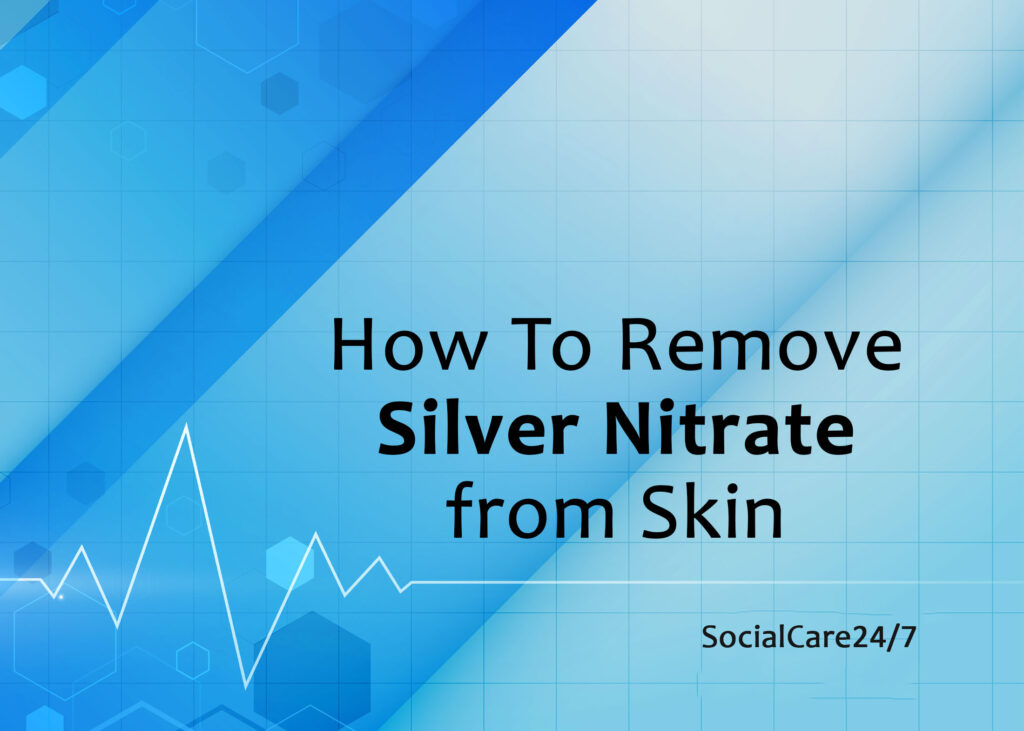 how to remove silver nitrate from skin