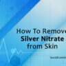 how to remove silver nitrate from skin