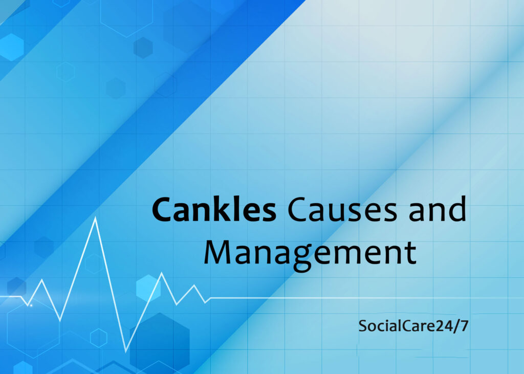 cankles causes and management