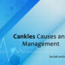 cankles causes and management