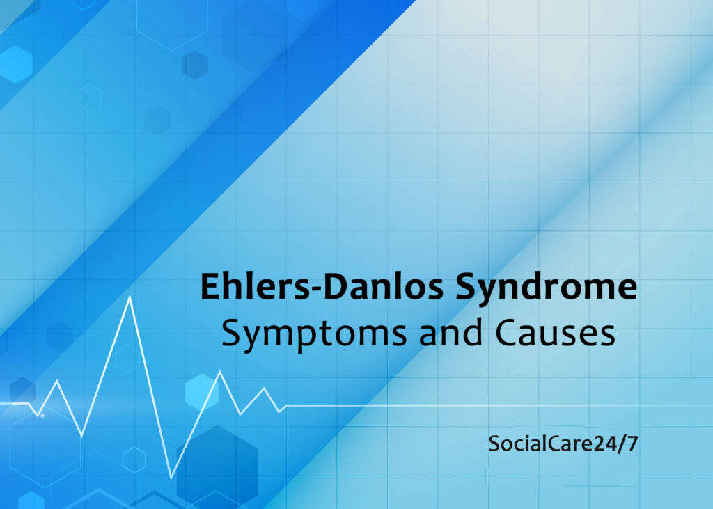 ehlers danlos syndrome