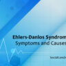 ehlers danlos syndrome