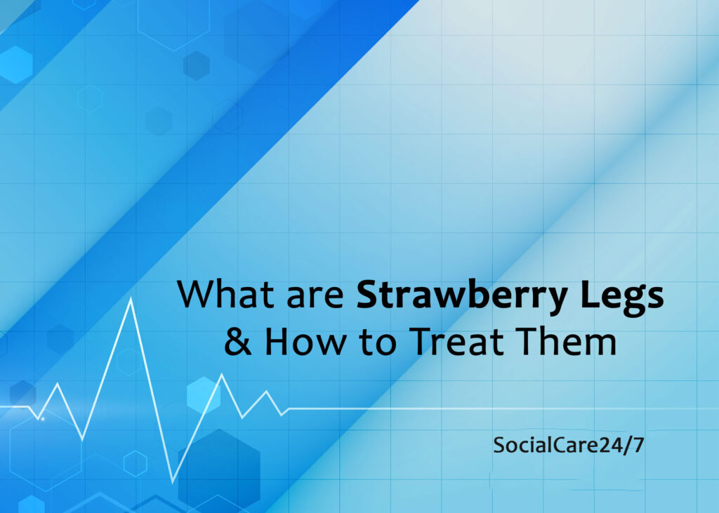 What Are Strawberry Legs & How To Treat Them